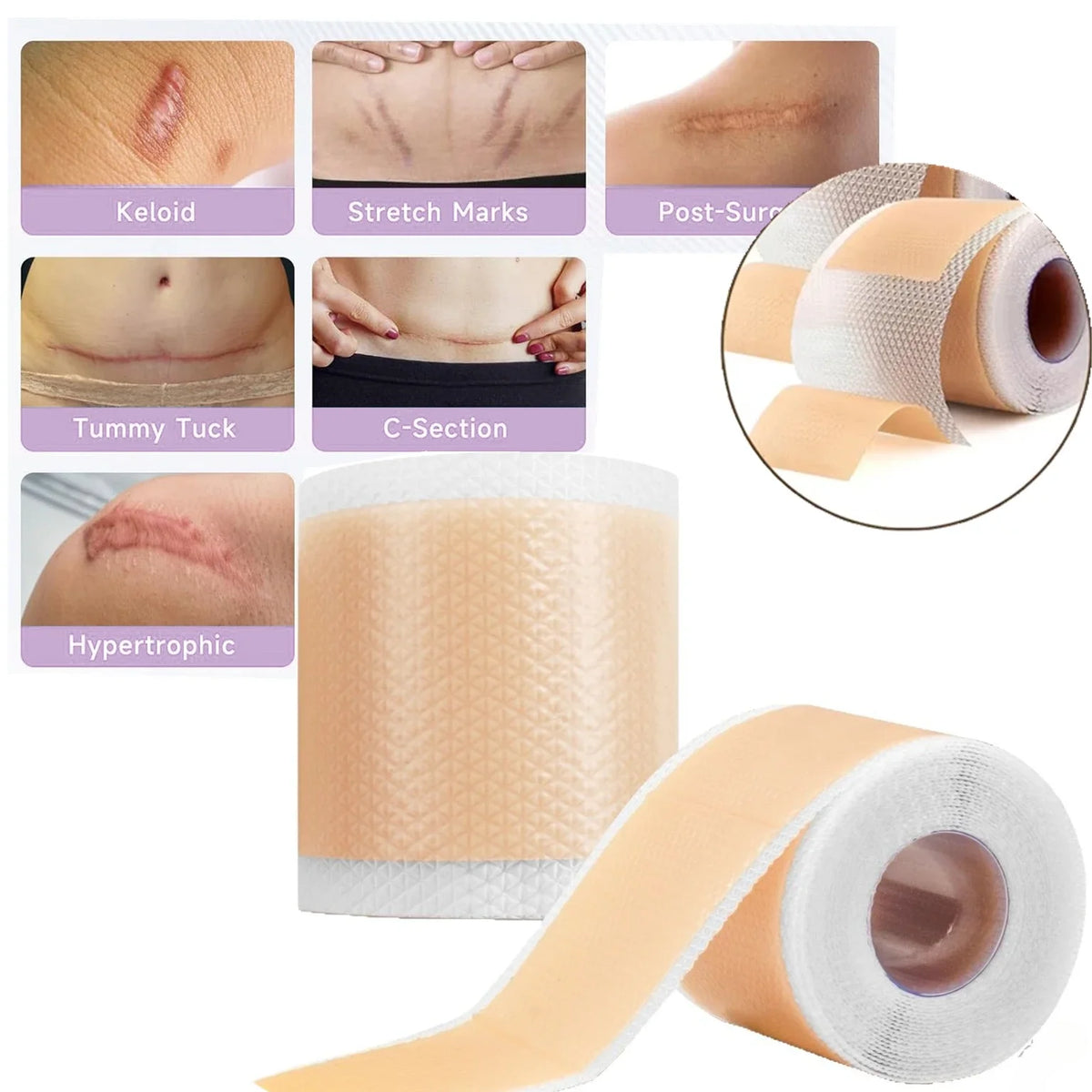 Silicone Scar Tape – Waterproof Reusable Breathable Skin Tape