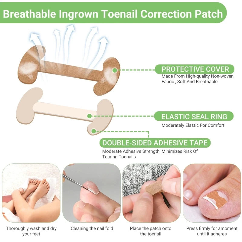 Toenail Correction Strips – Waterproof Elastic Nail Stickers