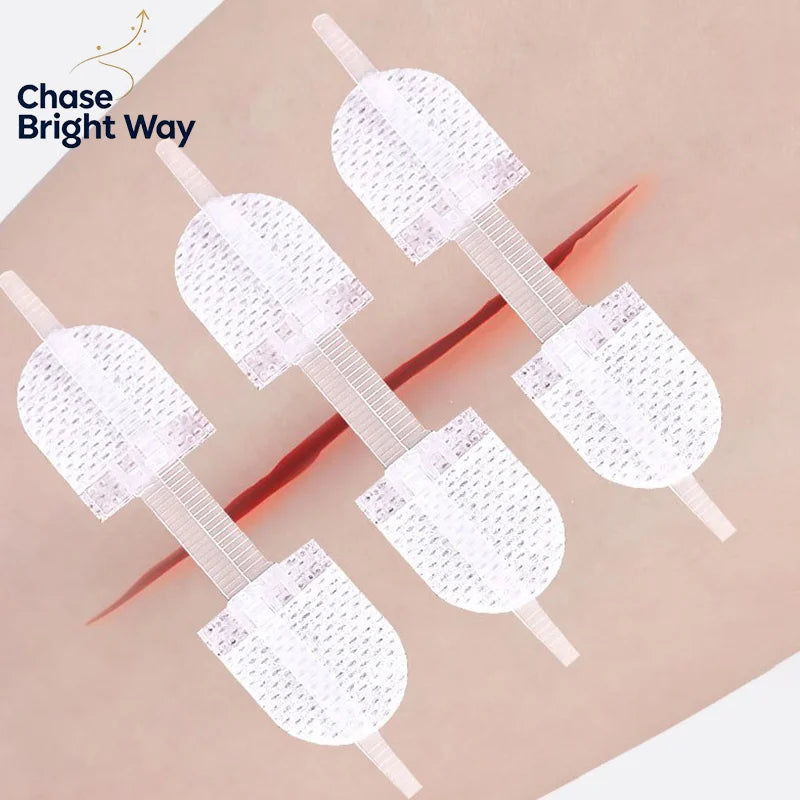 Zipper Wound Closure Patches – Elastic Breathable Strips 2-Pack