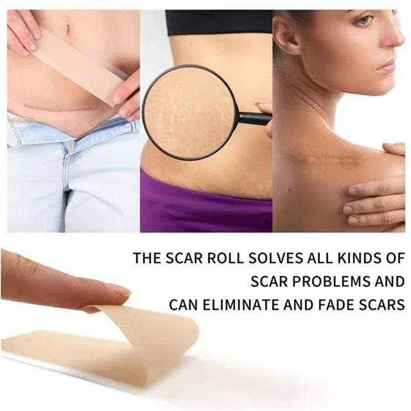 Silicone Scar Tape – Waterproof Reusable Breathable Skin Tape