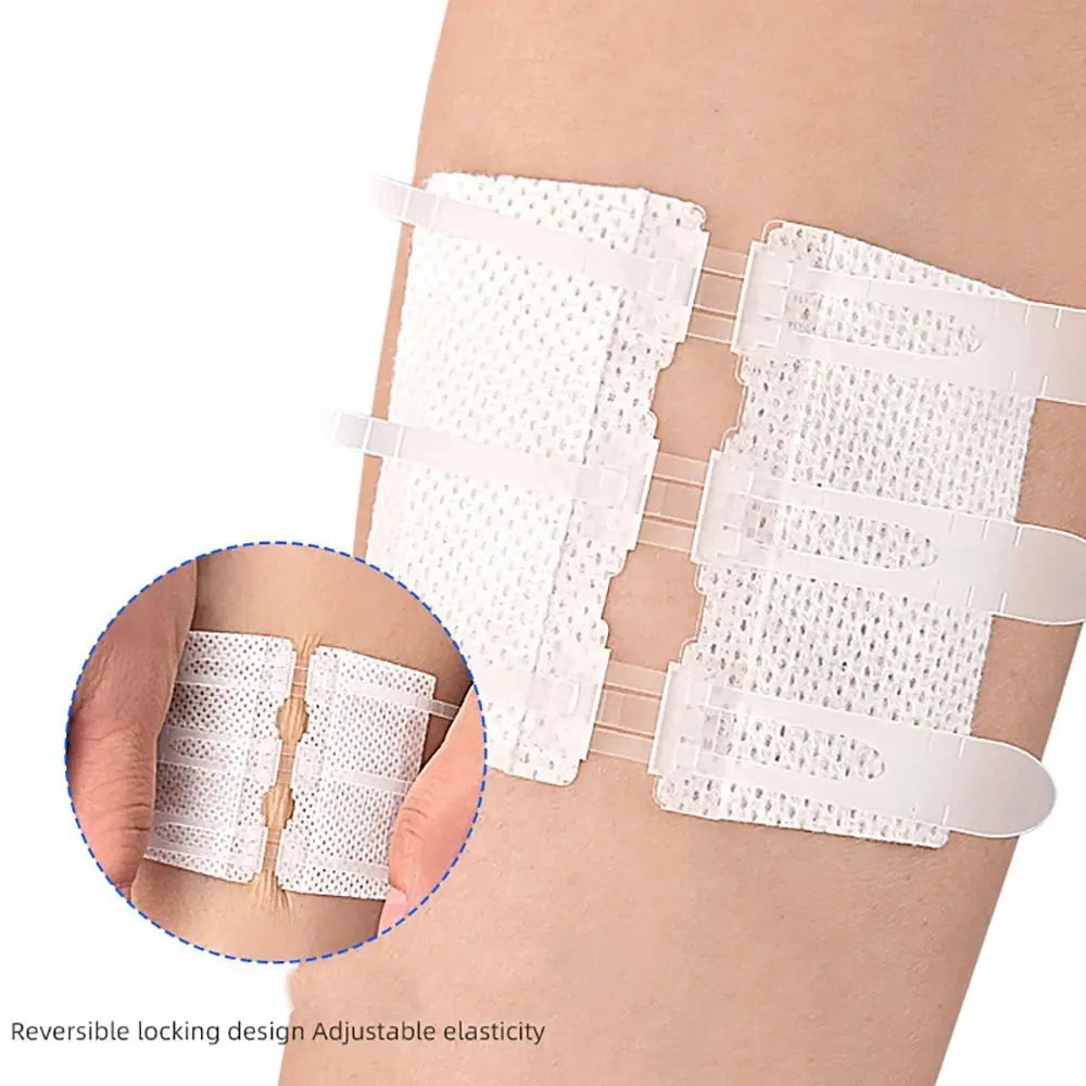 Zip Suture Wound Closure Strips – No-Stitch First Aid Bandage