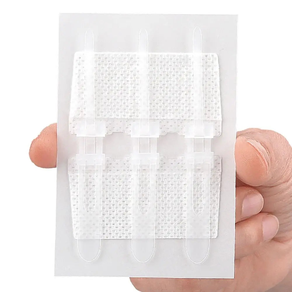 Zip Suture Wound Closure Strips – No-Stitch First Aid Bandage