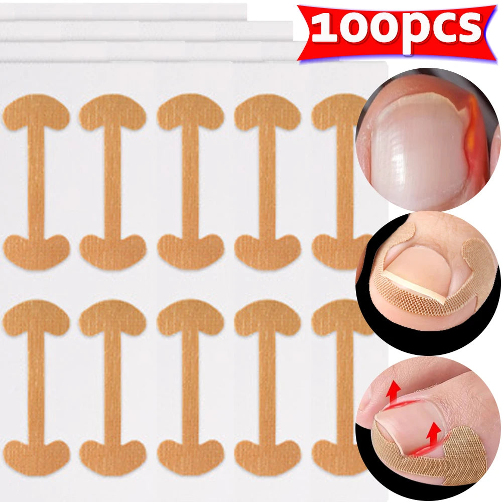 Toenail Correction Strips – Waterproof Elastic Nail Stickers 20–100pc
