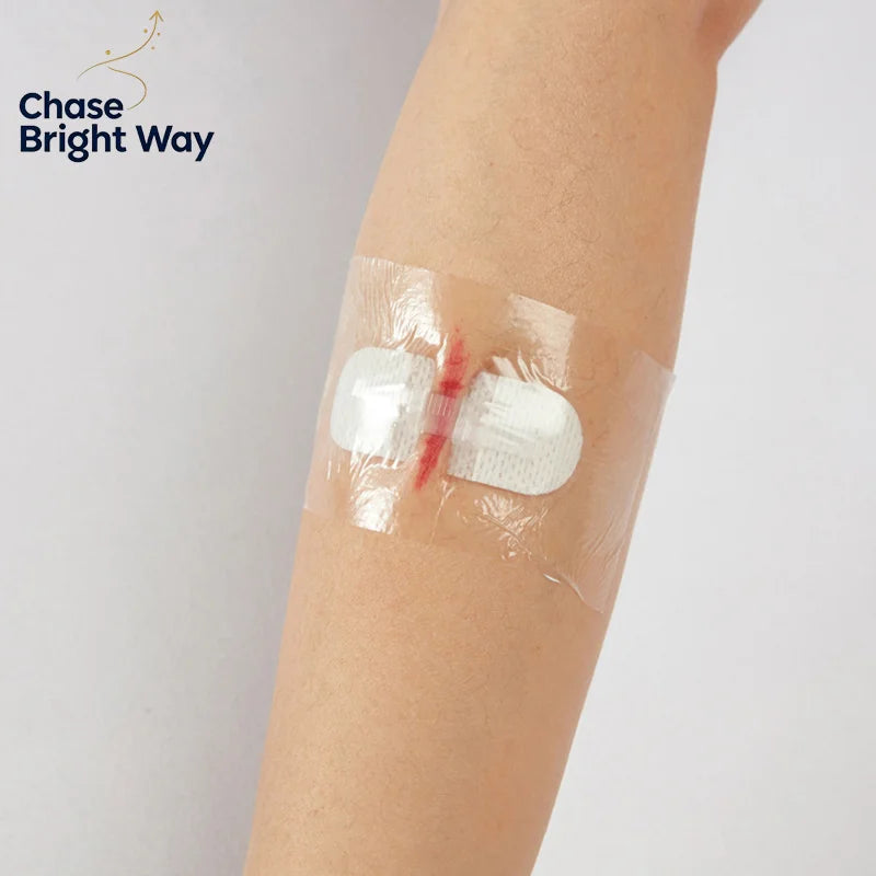 Sterile Wound Closure Strips – Scar Reduction Adhesive Tape