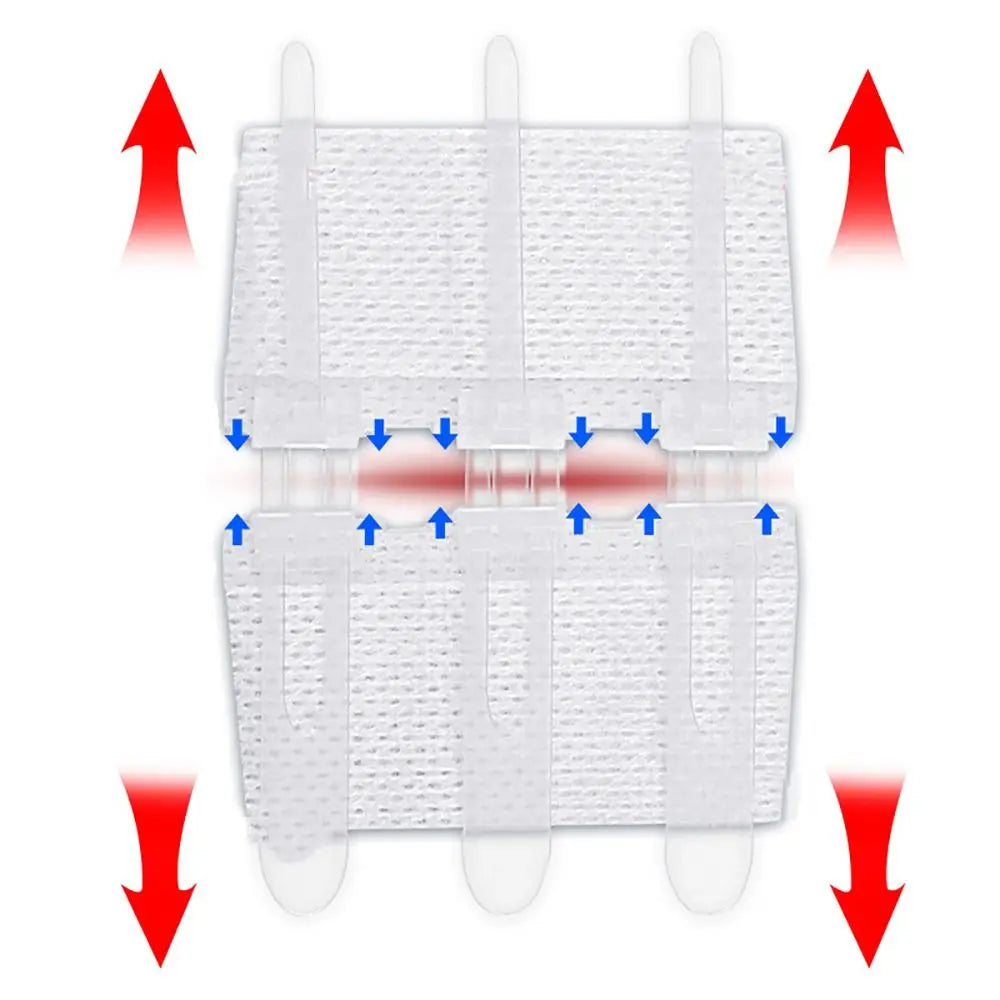 Zip Suture Wound Closure Strips – No-Stitch First Aid Bandage
