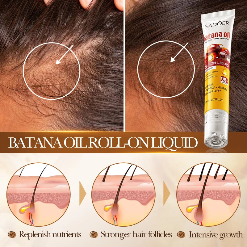 SADOER Batana Oil Roll-On Hair Growth Serum | Scalp Treatment