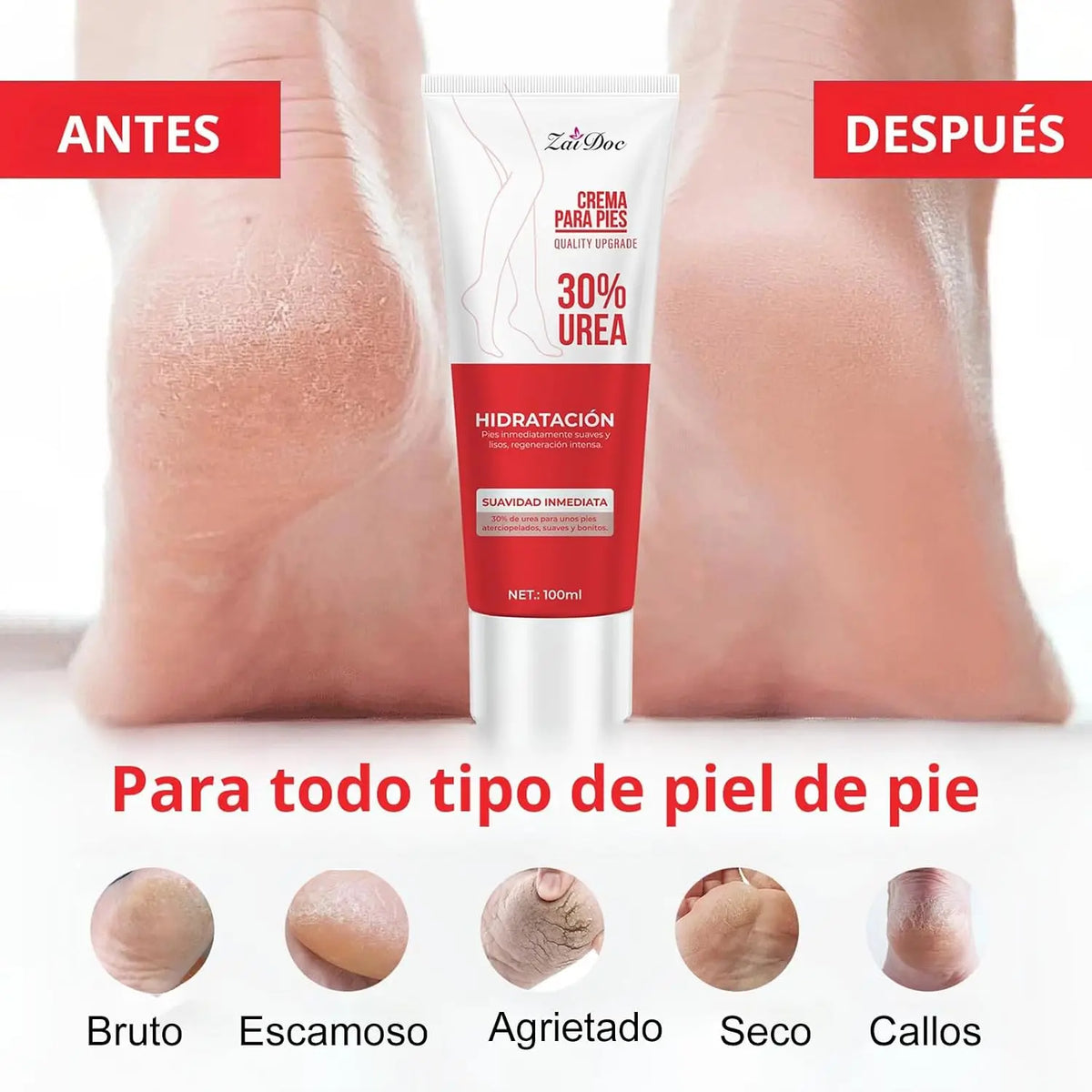 Urea Foot Cream 100ml – Moisturizing Heel Balm for Dry Feet