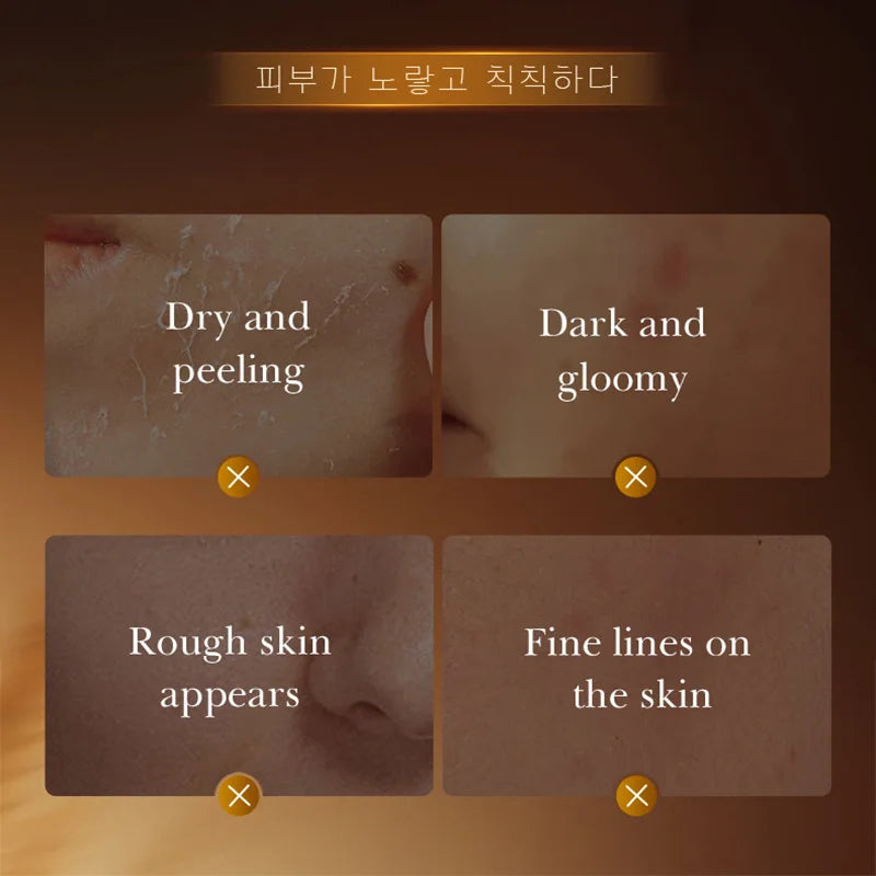 SADOER White Rice Brightening Face Masks – Hydrating & Firming