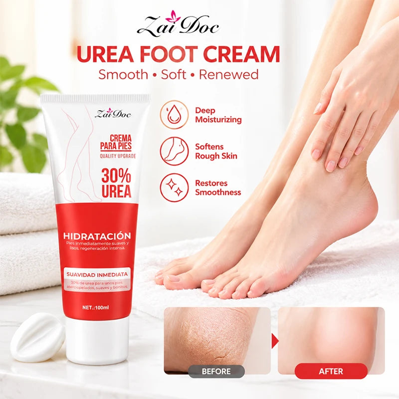 Urea Foot Cream 100ml – Moisturizing Heel Balm for Dry Feet
