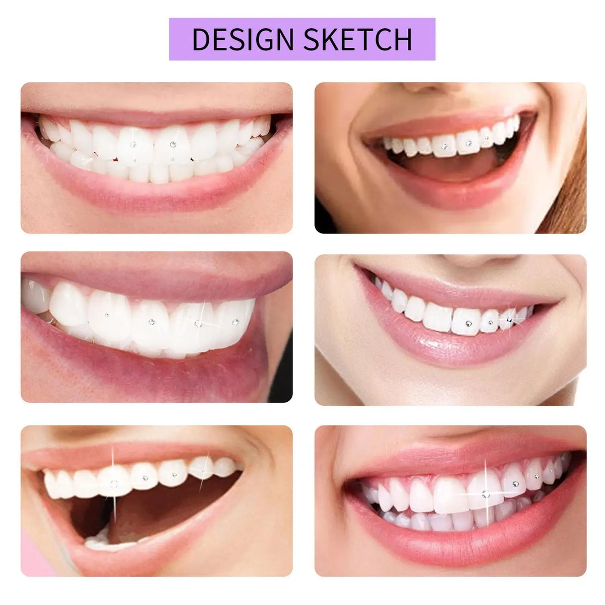 DIY Tooth Gem Kit – Crystal Tooth Jewelry with UV LED Light