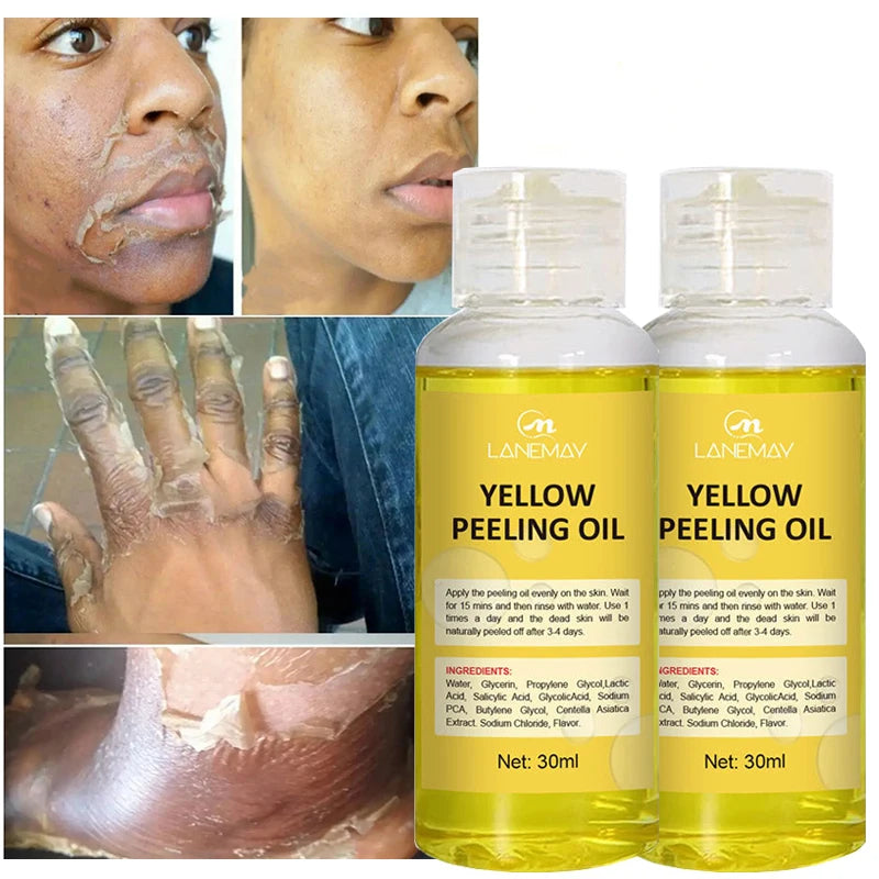 Yellow Peeling Oil Exfoliating Serum – Brighten & Smooth Skin