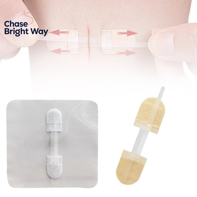 Zipper Wound Closure Patches – Breathable Elastic 2-Pack