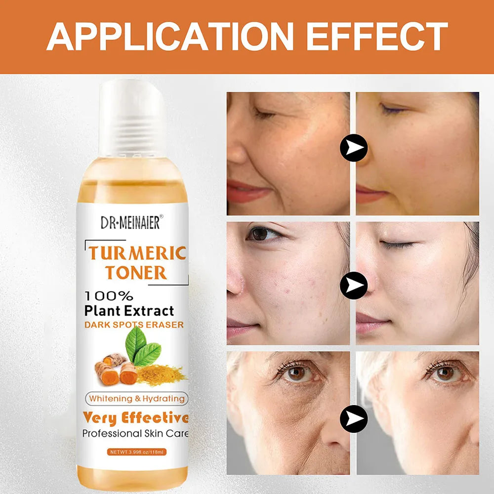 Turmeric Facial Toner 118ml – Dark Spot Corrector & Glow