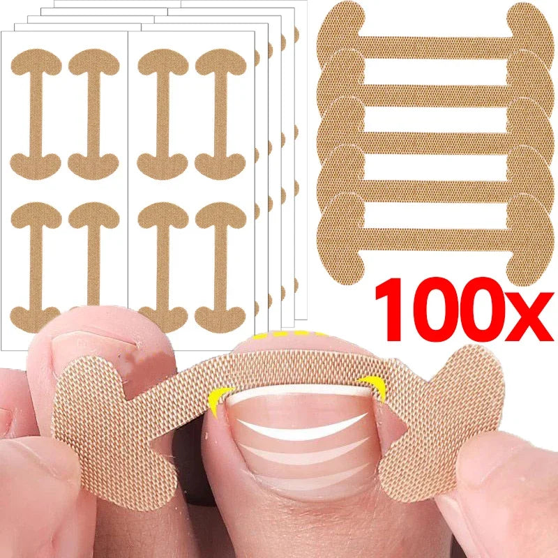 Toenail Correction Strips – Waterproof Elastic Nail Stickers 20–100pc