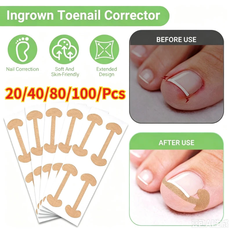 Toenail Correction Strips – Waterproof Elastic Nail Stickers