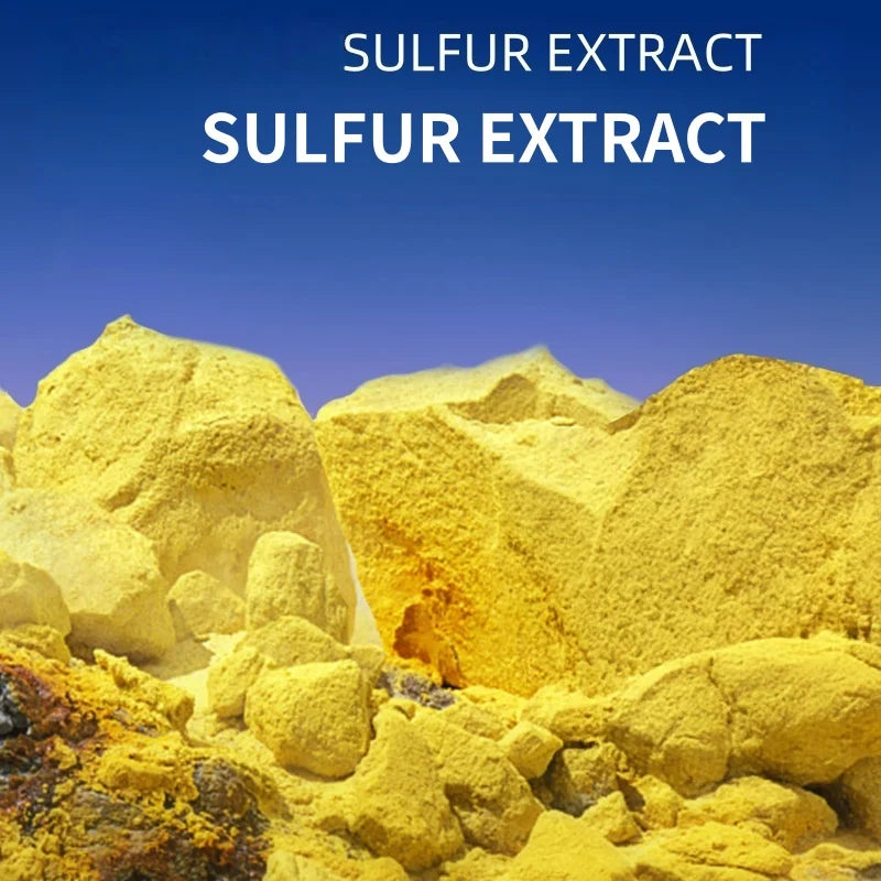 Sulfur & Aloe Vera Cleansing Soap – Oil Control 100g Bar