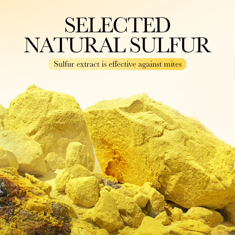 Sadoer Sulfur Handmade Facial & Body Cleansing Soap 1-2 Pcs