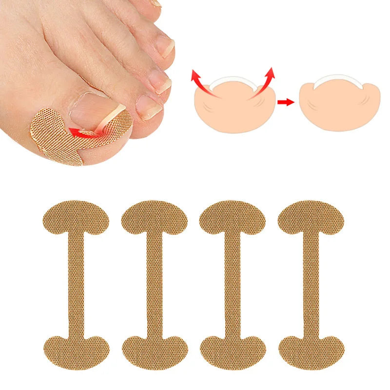 Toenail Correction Strips – Waterproof Elastic Nail Stickers 20–100pc