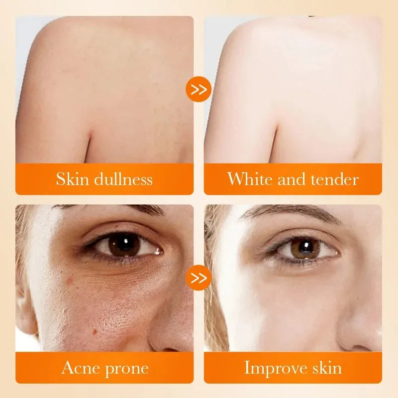 Sadoer Kojic Acid Facial Soap – Brightening Foam Cleanser