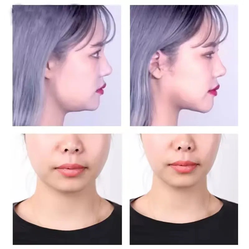 V-Shape Face Lifting Tape – Invisible Skin Tightening Stickers