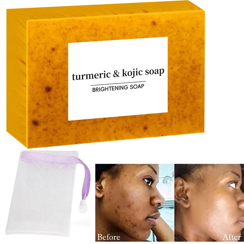 Turmeric Kojic Acid Glow Soap – Even Skin Tone Deep Cleanse