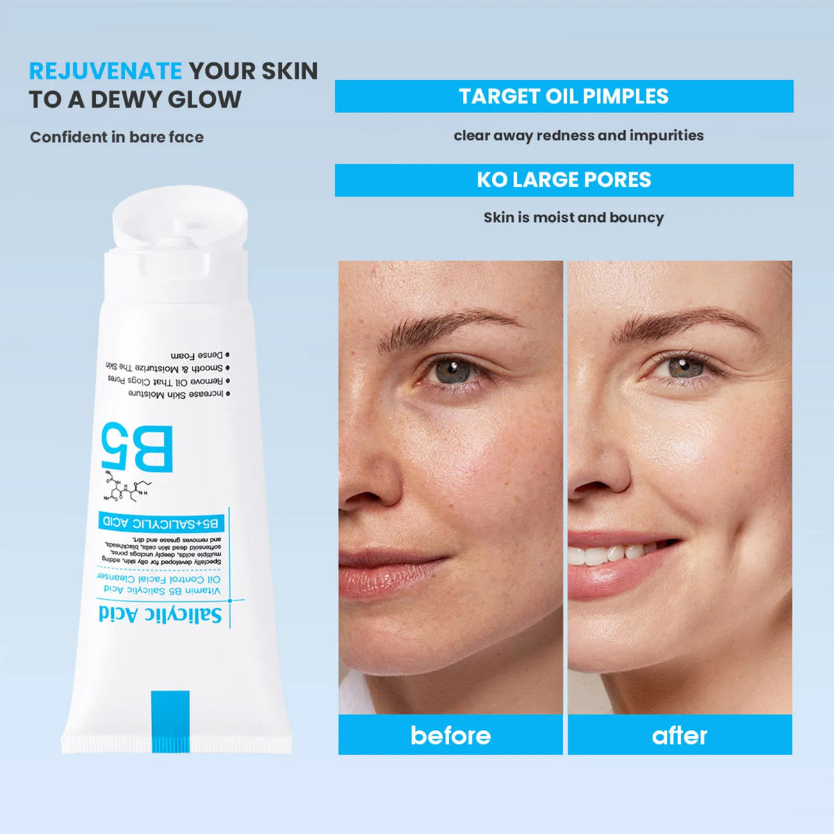 Vitamin B5 & Salicylic Acid Face Wash & Moisturizer Set