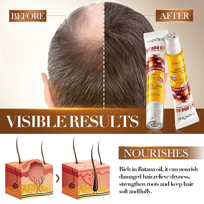 SADOER Batana Oil Roll-On Hair Growth Serum | Scalp Treatment
