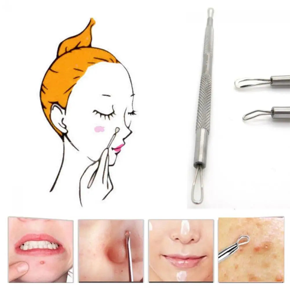 Stainless Steel Blackhead Extractor Tool – 2-Loop Blemish