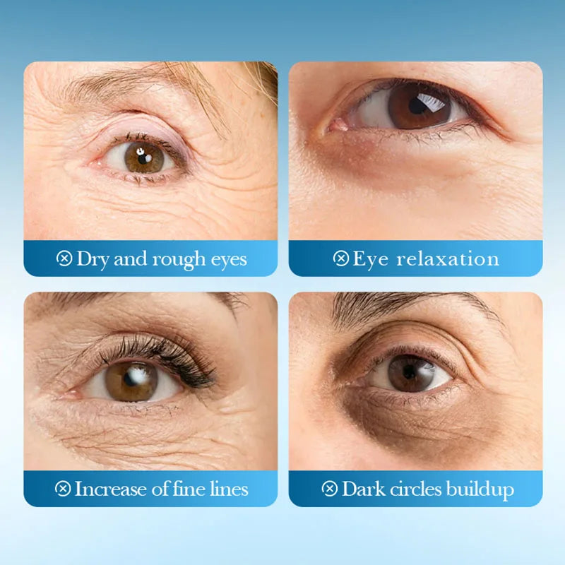 SADOER Seaweed Collagen Eye Masks 80 Pcs – Hydrating Gel Patches