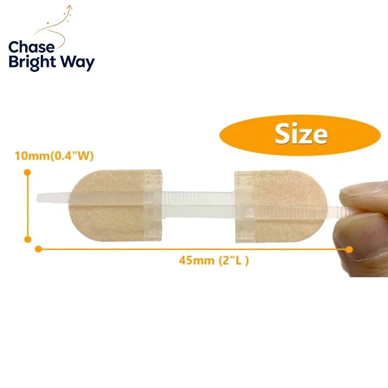Zipper Wound Closure Patches – Elastic Breathable Strips 2-Pack