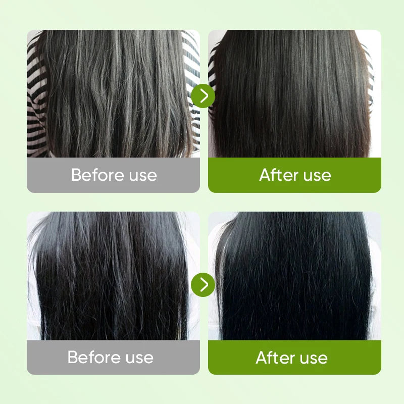 SADOER Aloe Vera Hair Mask 20 Pack – Moisturizing Treatment