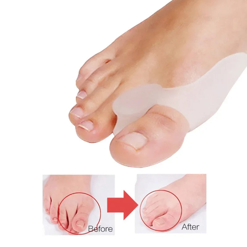 Silicone Toe Separator & Bunion Corrector – 1 Pair Foot Care