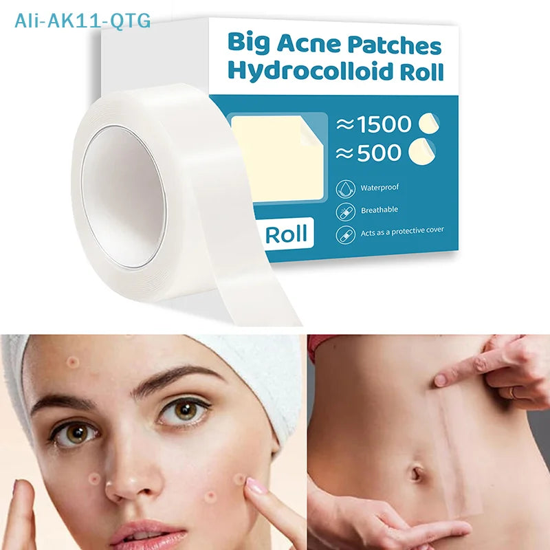 Hydrocolloid Bandage Roll – Self-Adhesive, Highly Absorbent