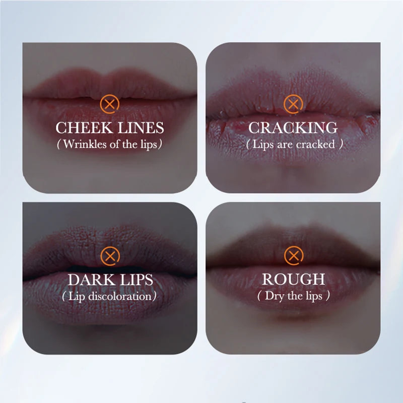 SADOER Snail Collagen Lip Mask – Moisturizing Plumping Patches