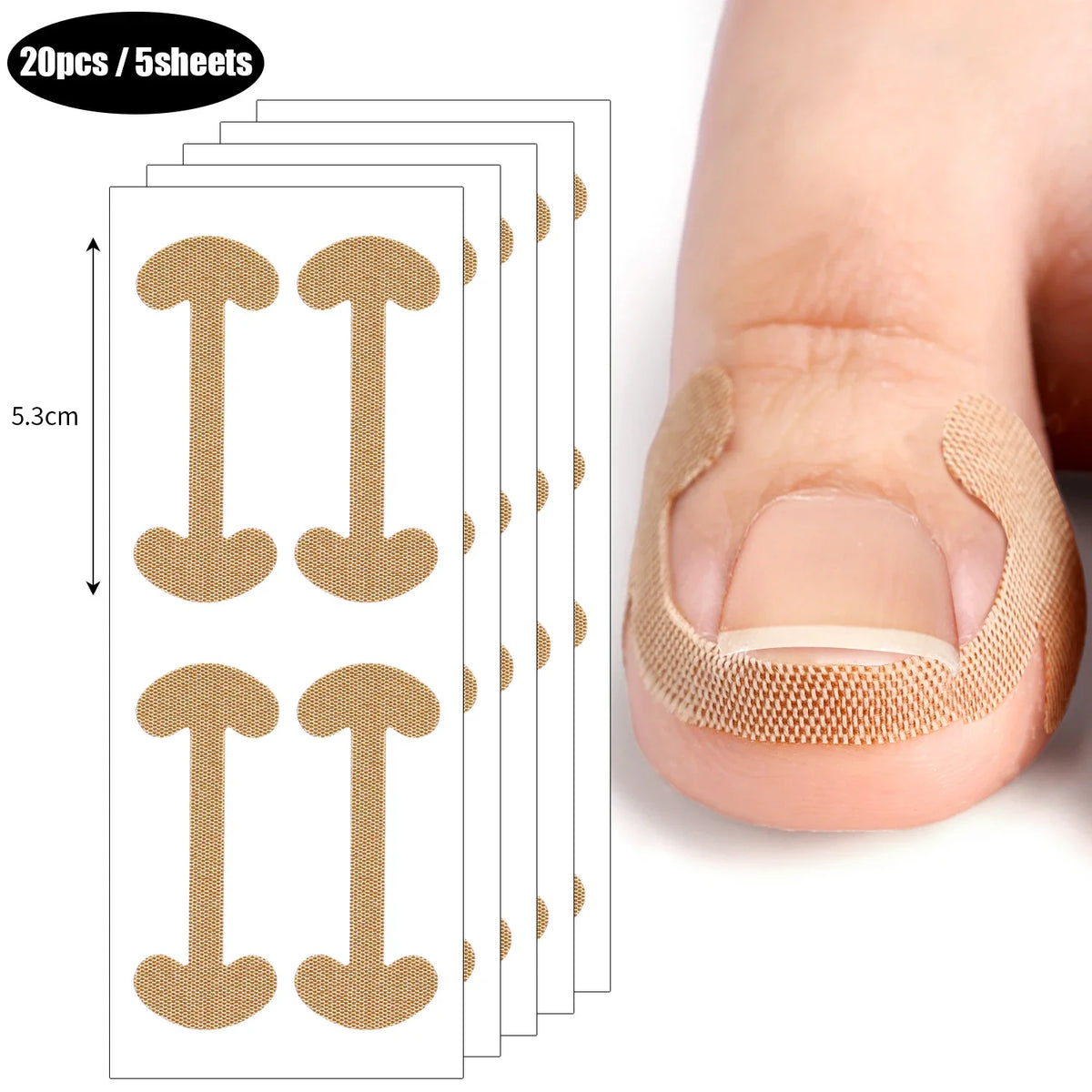 Toenail Correction Strips – Waterproof Elastic Nail Stickers 20–100pc