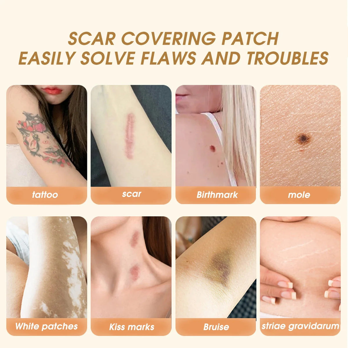 Skin Tone Concealer Patches – Hypoallergenic Cover-Up Stickers