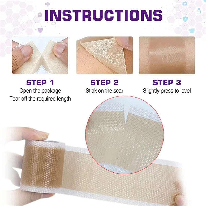 Silicone Scar Tape – Waterproof Reusable Breathable Skin Tape