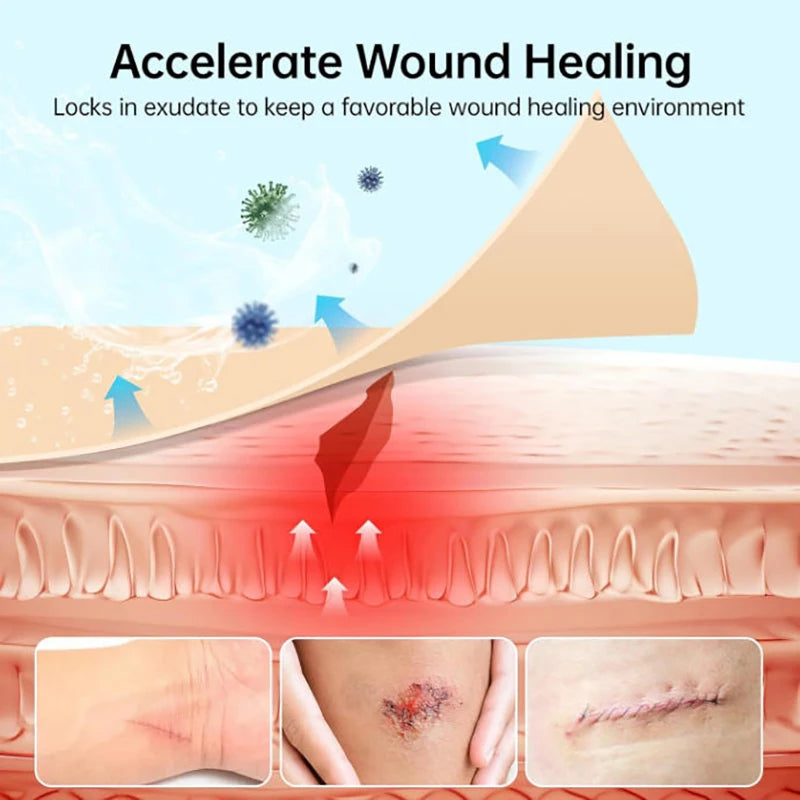 Hydrocolloid Roll Bandage – Self-Adhesive, Highly Absorbent