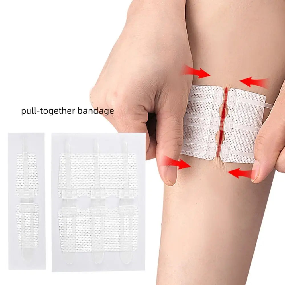 Zip Suture Wound Closure Strips – No-Stitch First Aid Bandage