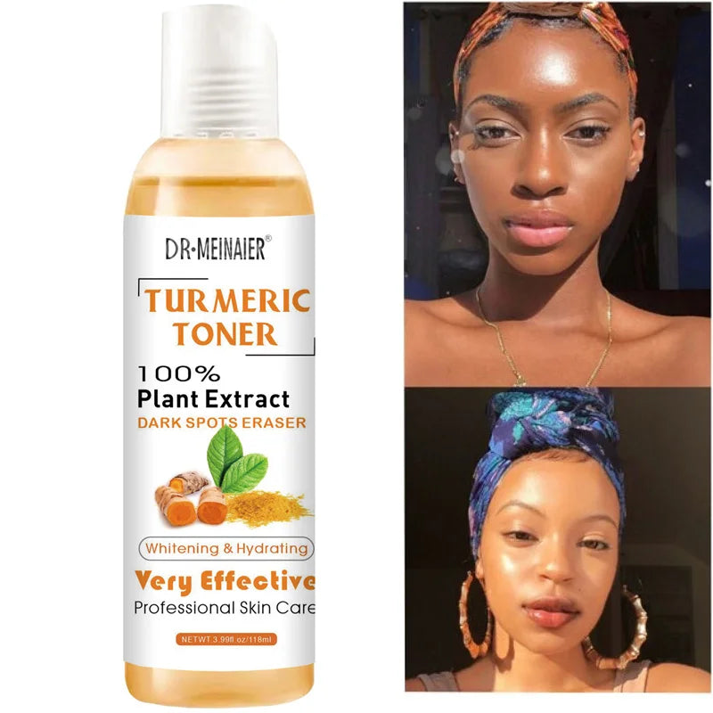 Turmeric Facial Toner 118ml – Dark Spot Corrector & Glow