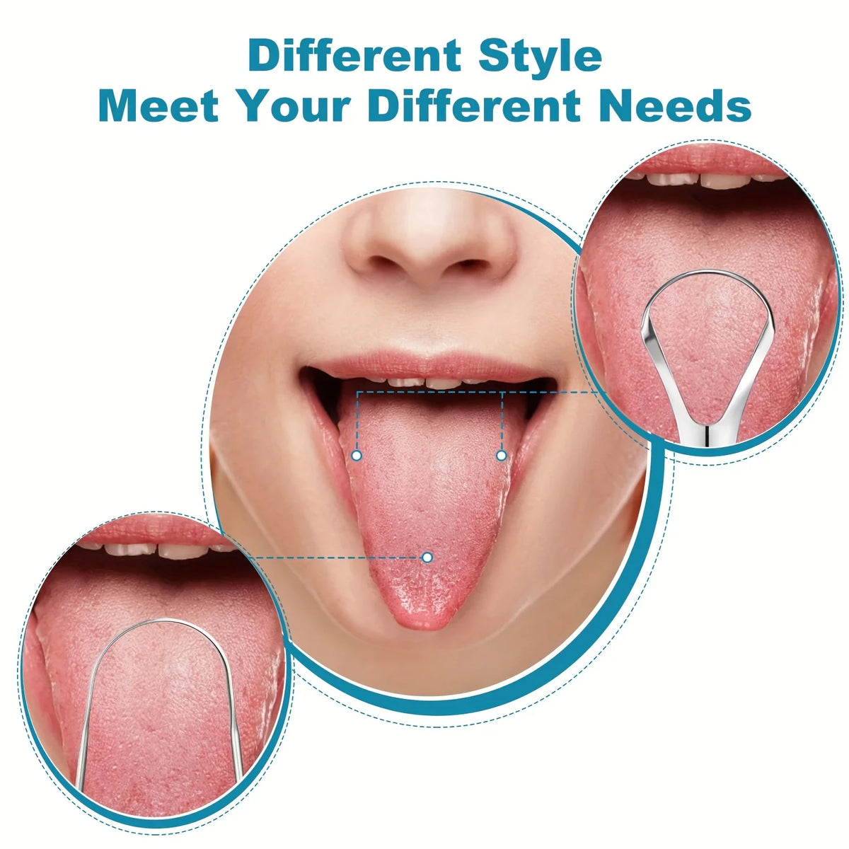 Stainless Steel Tongue Scraper – Home & Clinic Oral Care