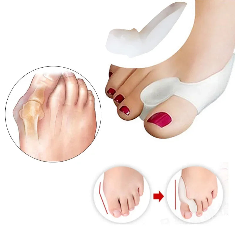 Silicone Toe Separator & Bunion Corrector – 1 Pair Foot Care