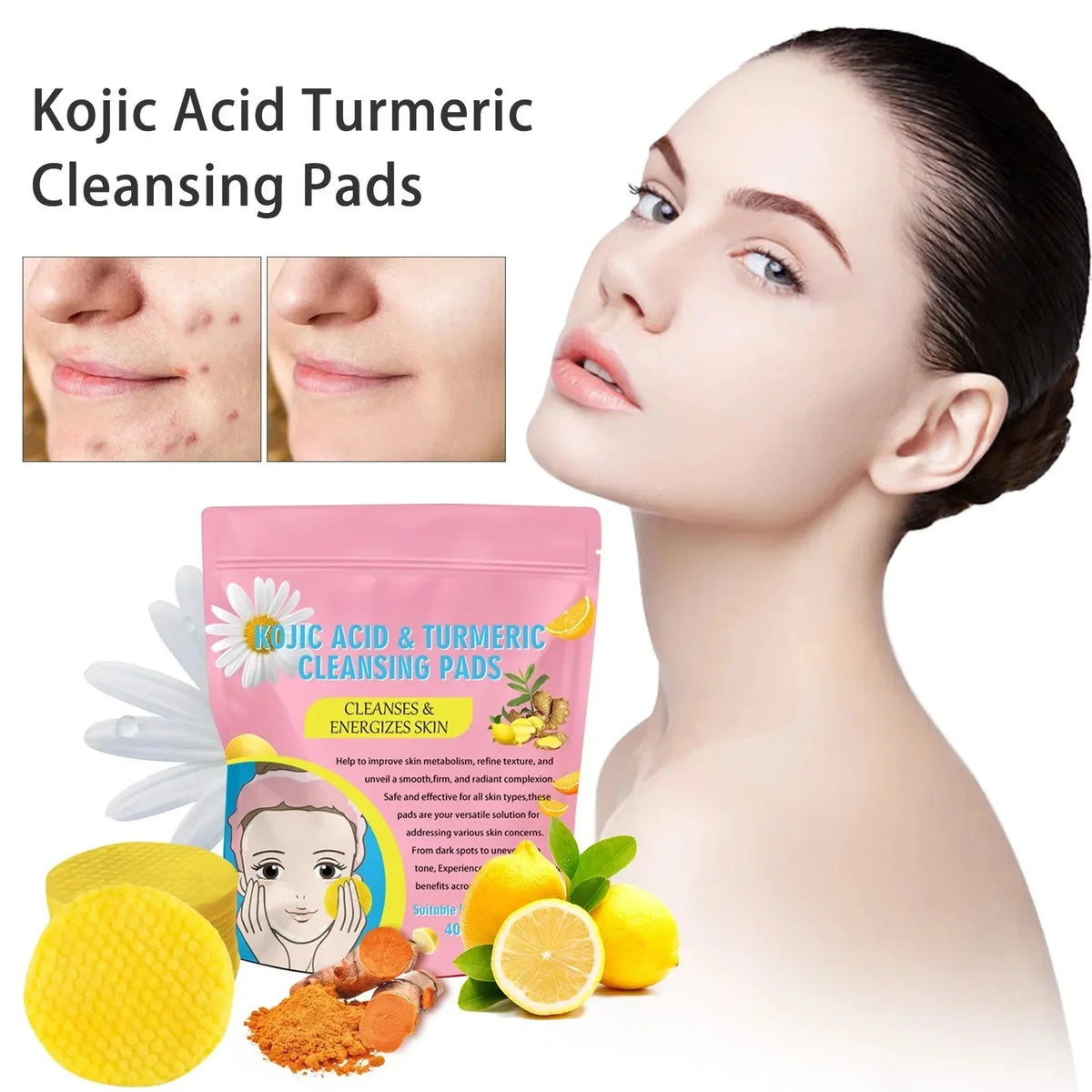 Turmeric Kojic Acid Cleansing Pads – 40-Pack Exfoliating Facial